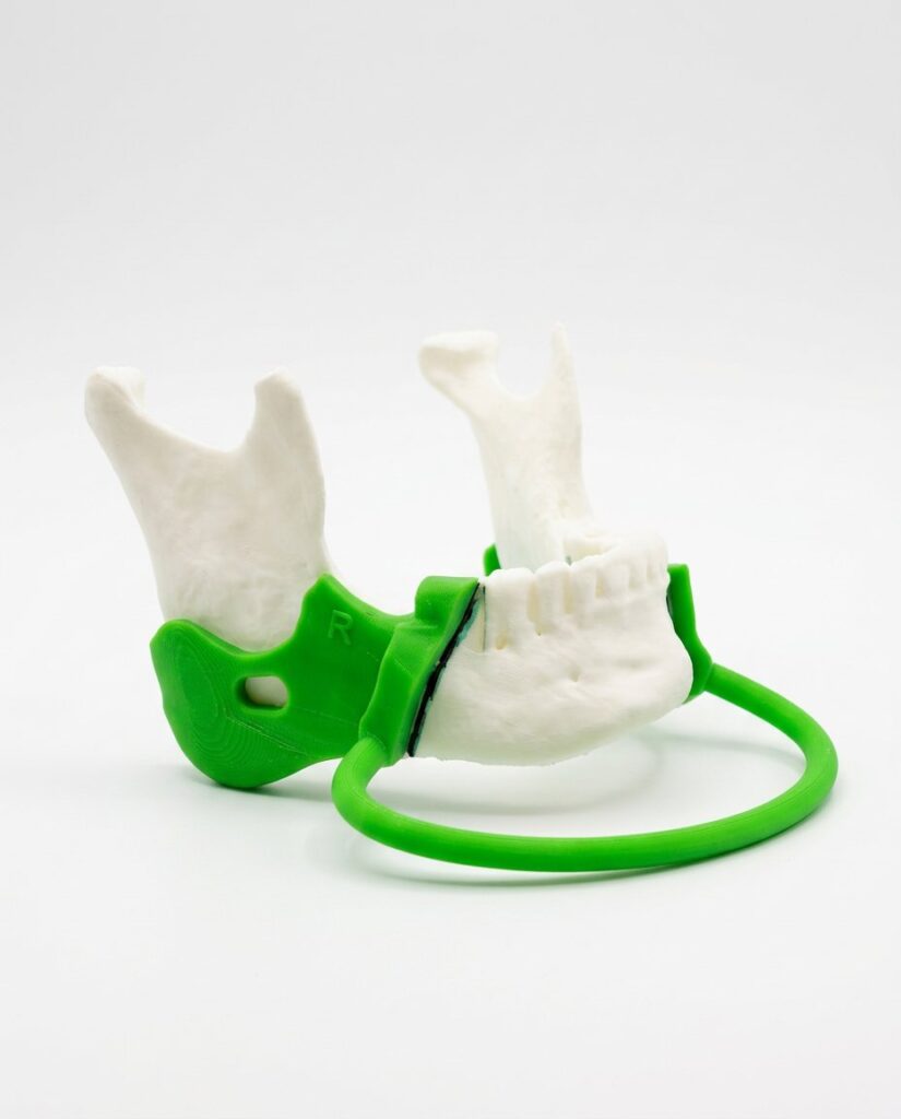 Prototipo impreso en 3D